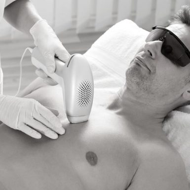 Men’s Guide to Laser Hair Removal