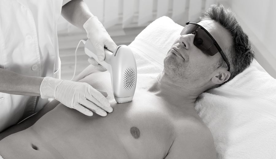 Men’s Guide to Laser Hair Removal