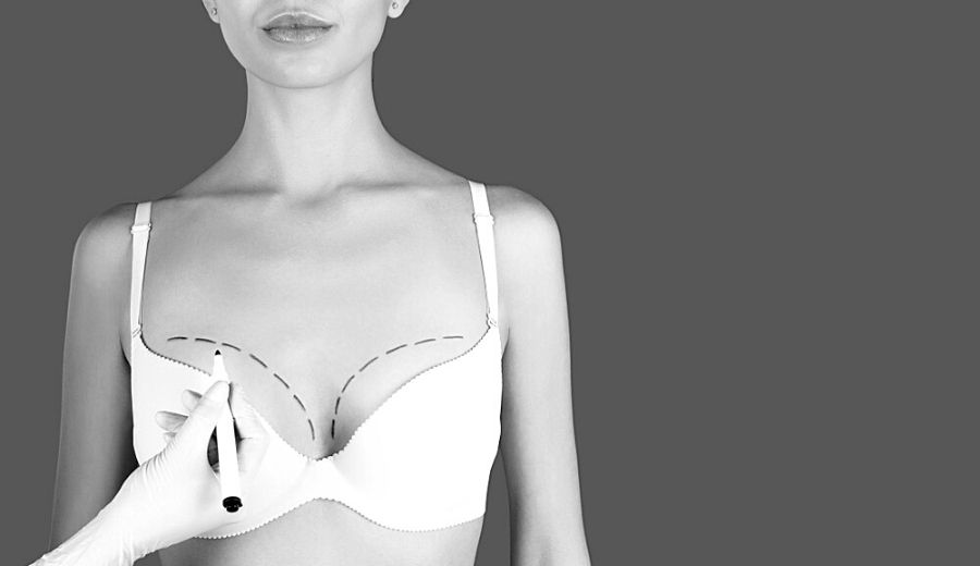 Can you wear underwire bras after breast augmentation? Absolutely