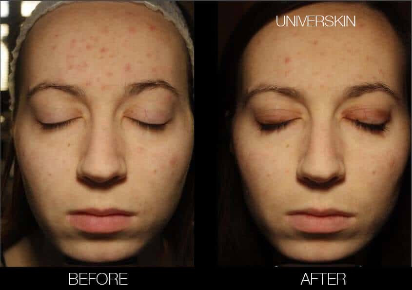 Universkin - Before and After Gallery – Photo 10