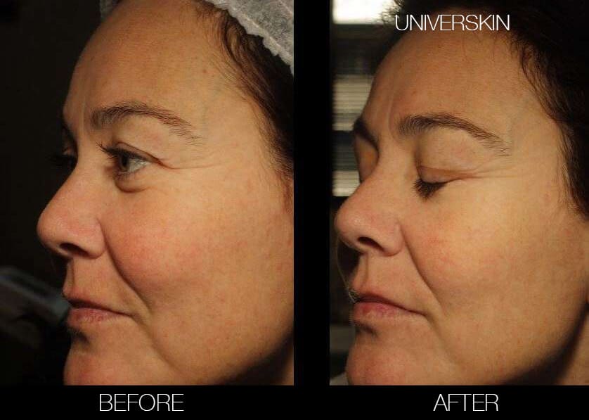 Universkin - Before and After Gallery – Photo 11
