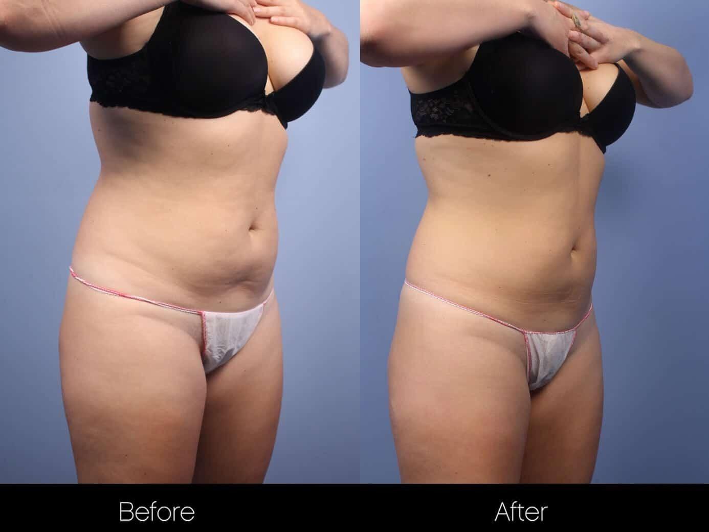 Evolve - Before and After Gallery – Photo 12