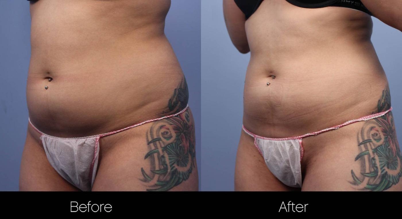 Evolve - Before and After Gallery – Photo 5