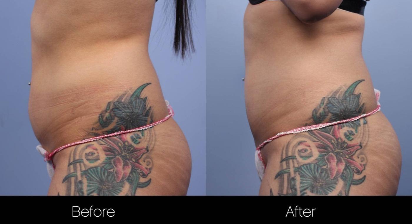 Evolve - Before and After Gallery – Photo 6