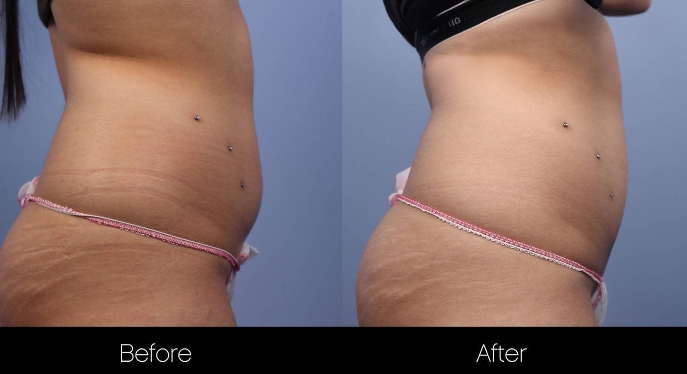 Evolve - Before and After Gallery – Photo 7