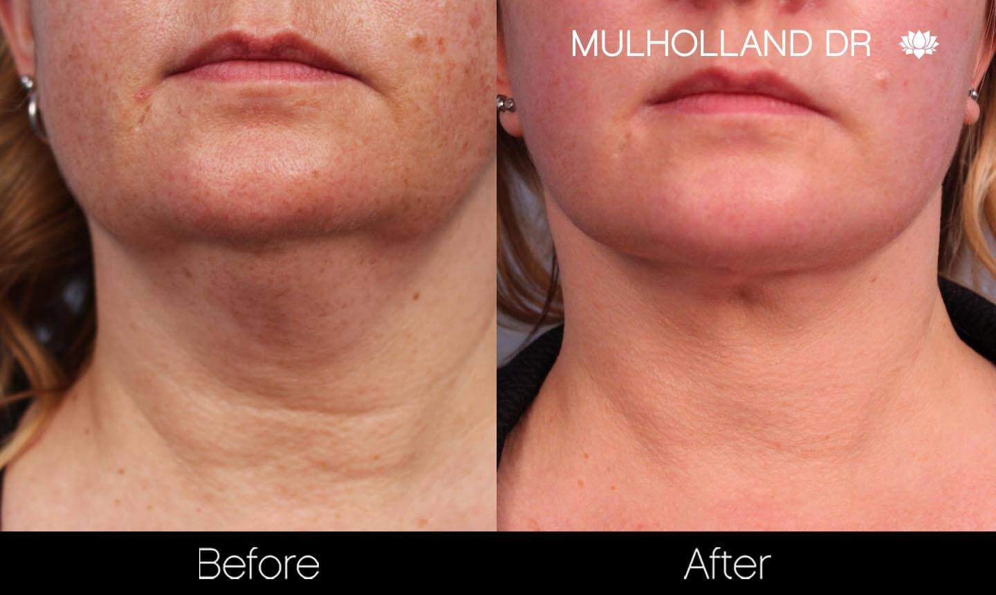 Universkin - Before and After Gallery – Photo 5