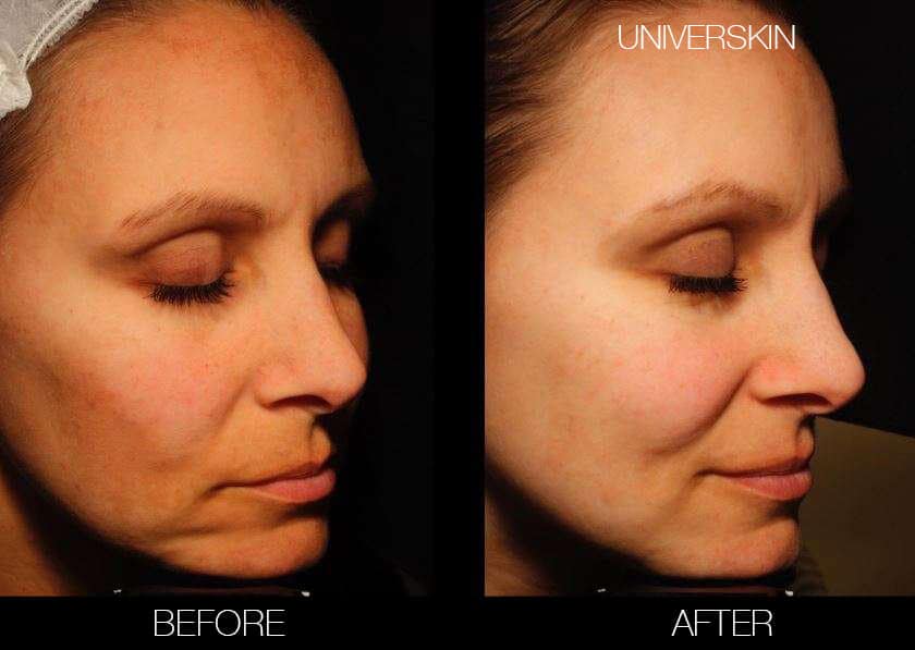 Universkin - Before and After Gallery – Photo 9