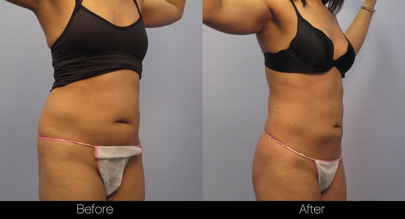 Evolve - Before and After Gallery – Photo 24
