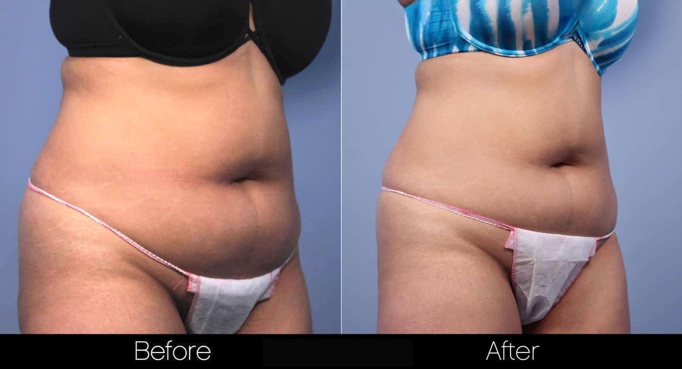 Evolve - Before and After Gallery – Photo 30