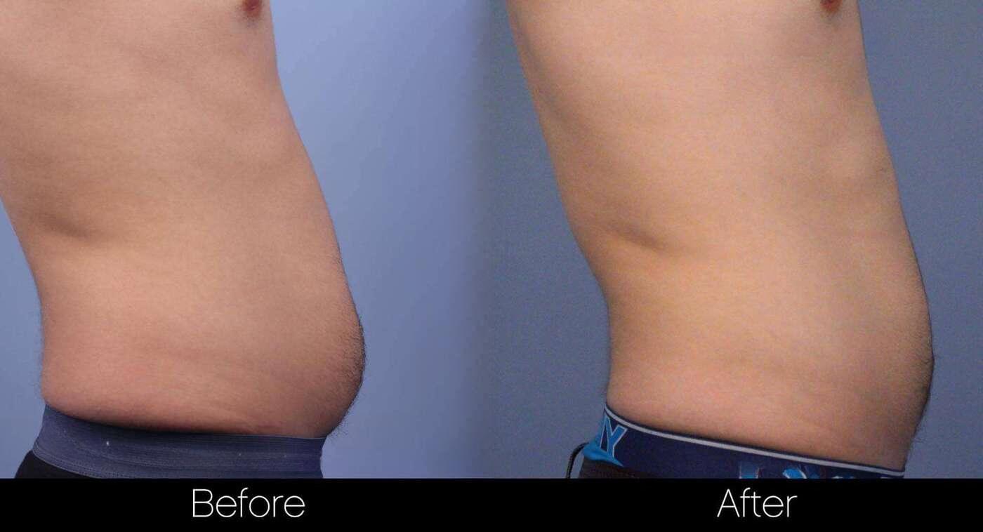 Evolve - Before and After Gallery – Photo 16