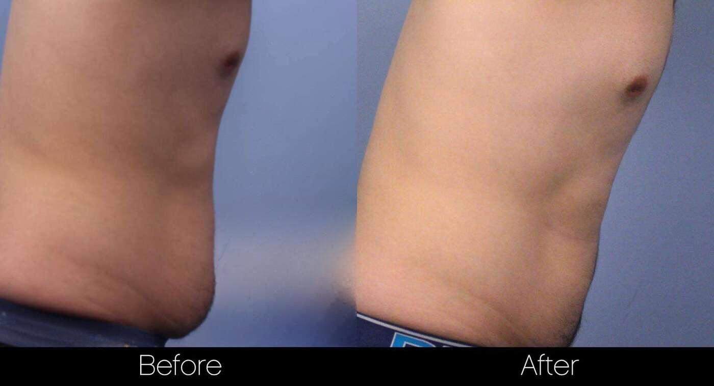 Evolve - Before and After Gallery – Photo 17