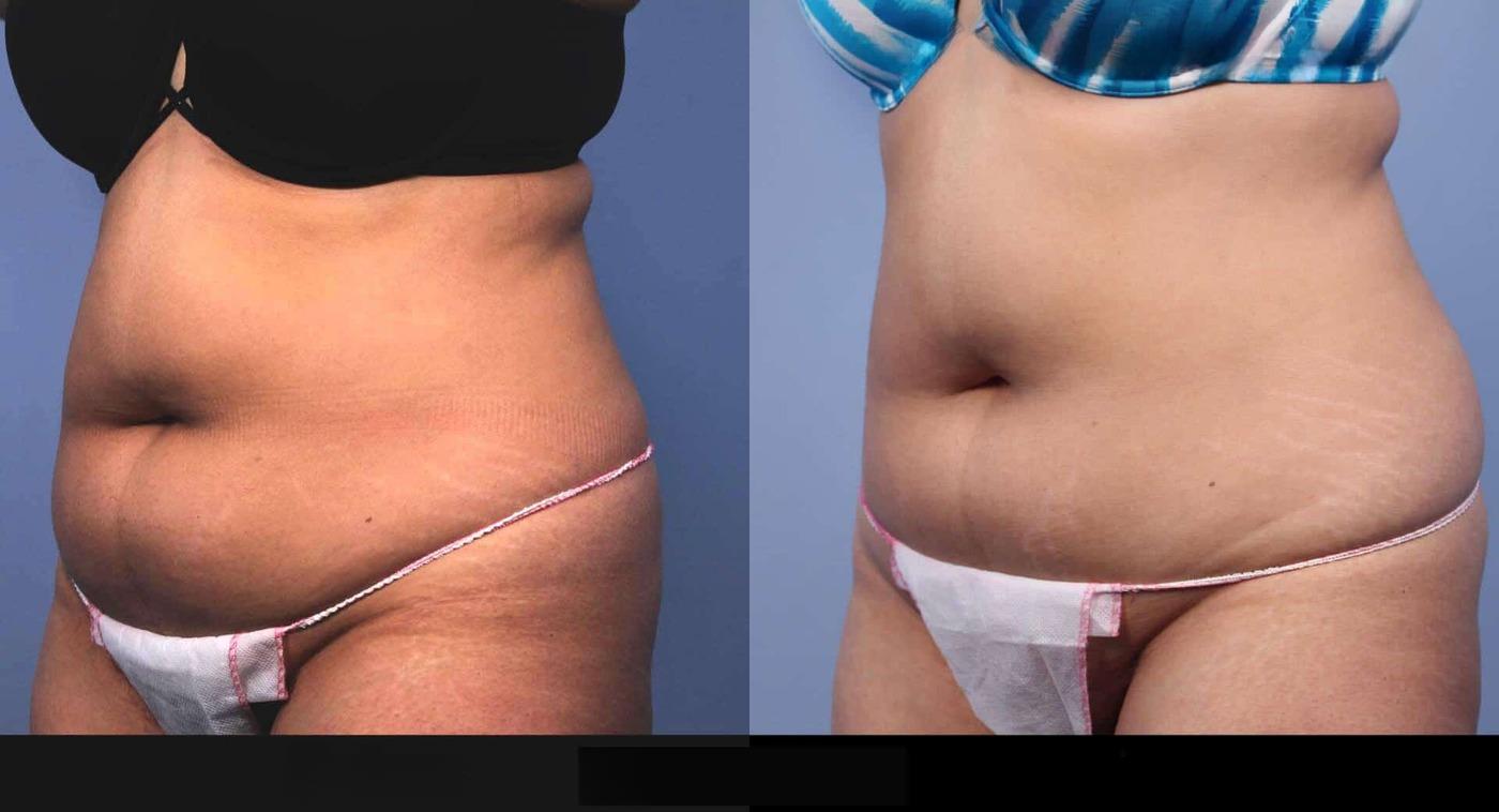 Evolve - Before and After Gallery – Photo 31