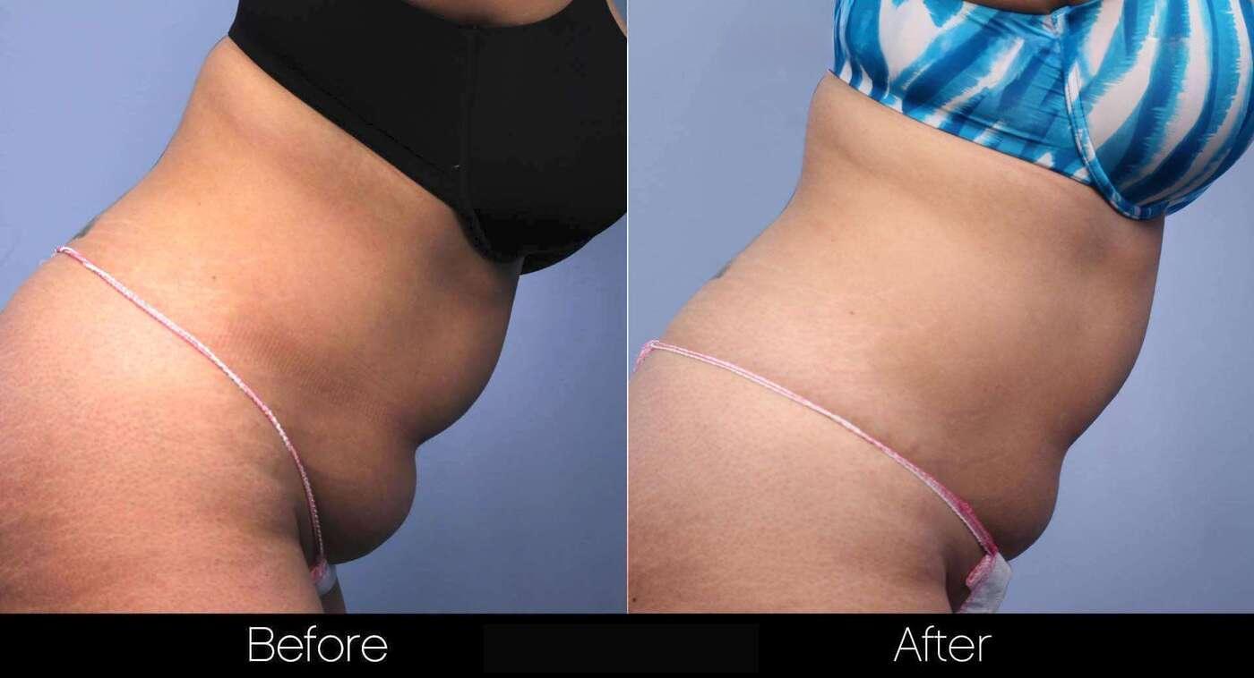 Evolve - Before and After Gallery – Photo 32