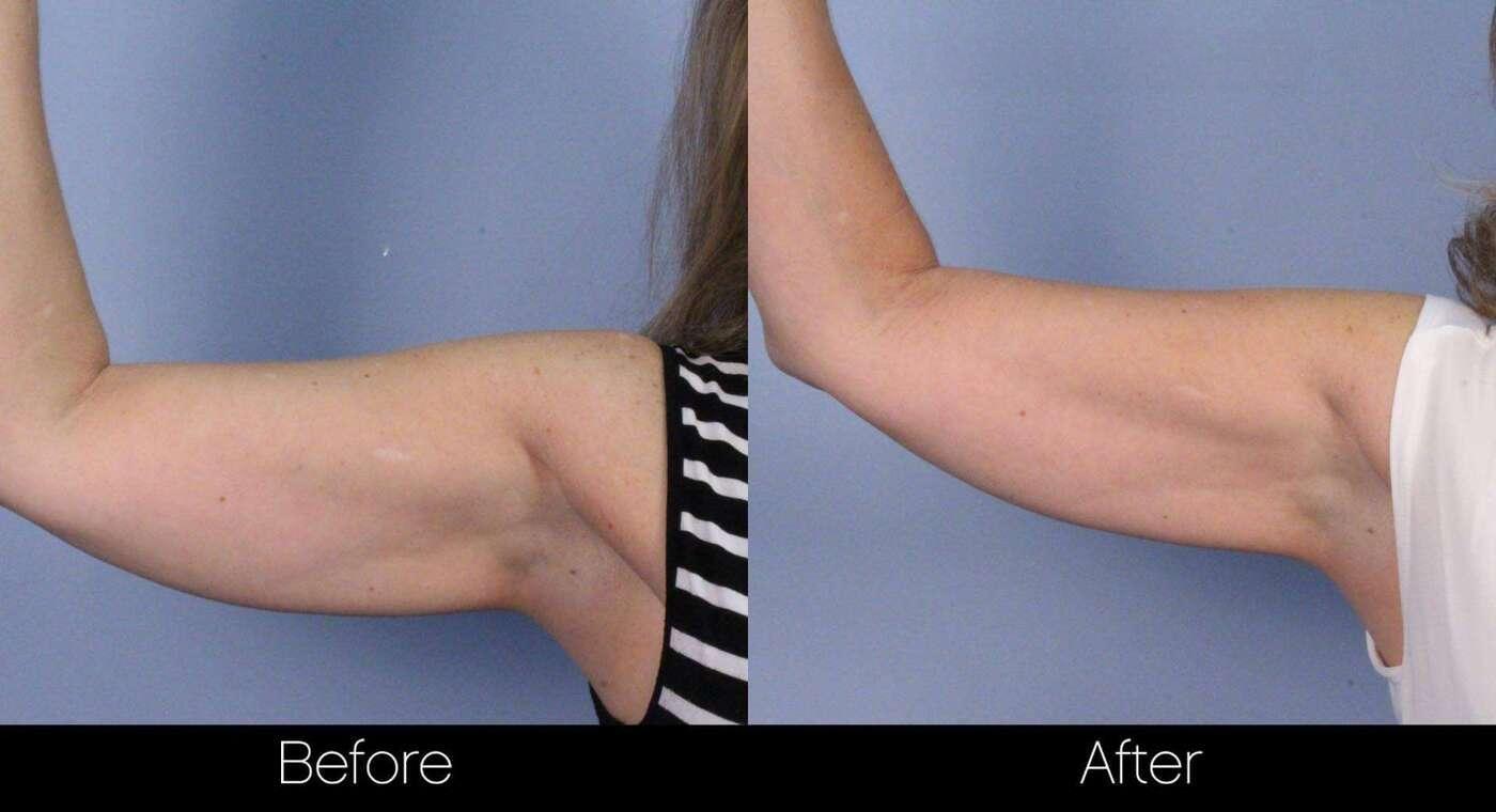 Evolve - Before and After Gallery – Photo 44