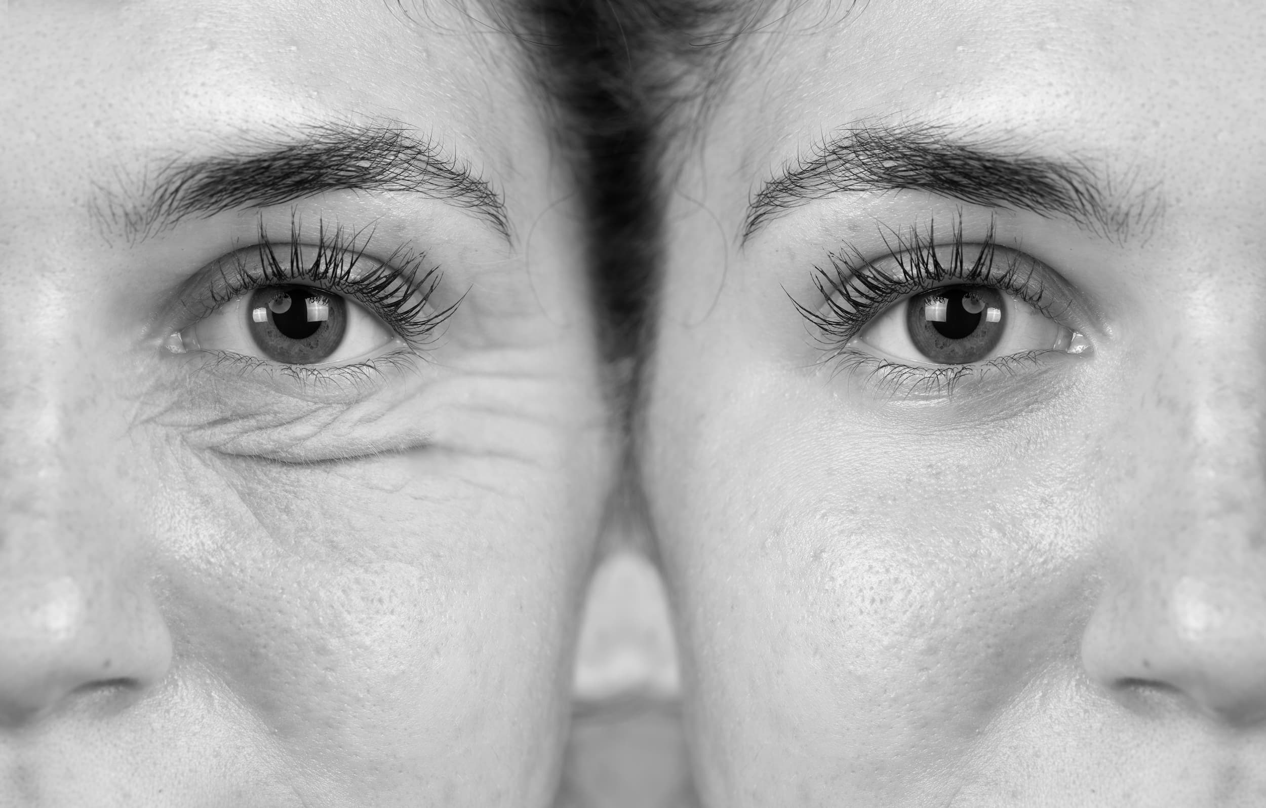 before and after photo of woman's eyes