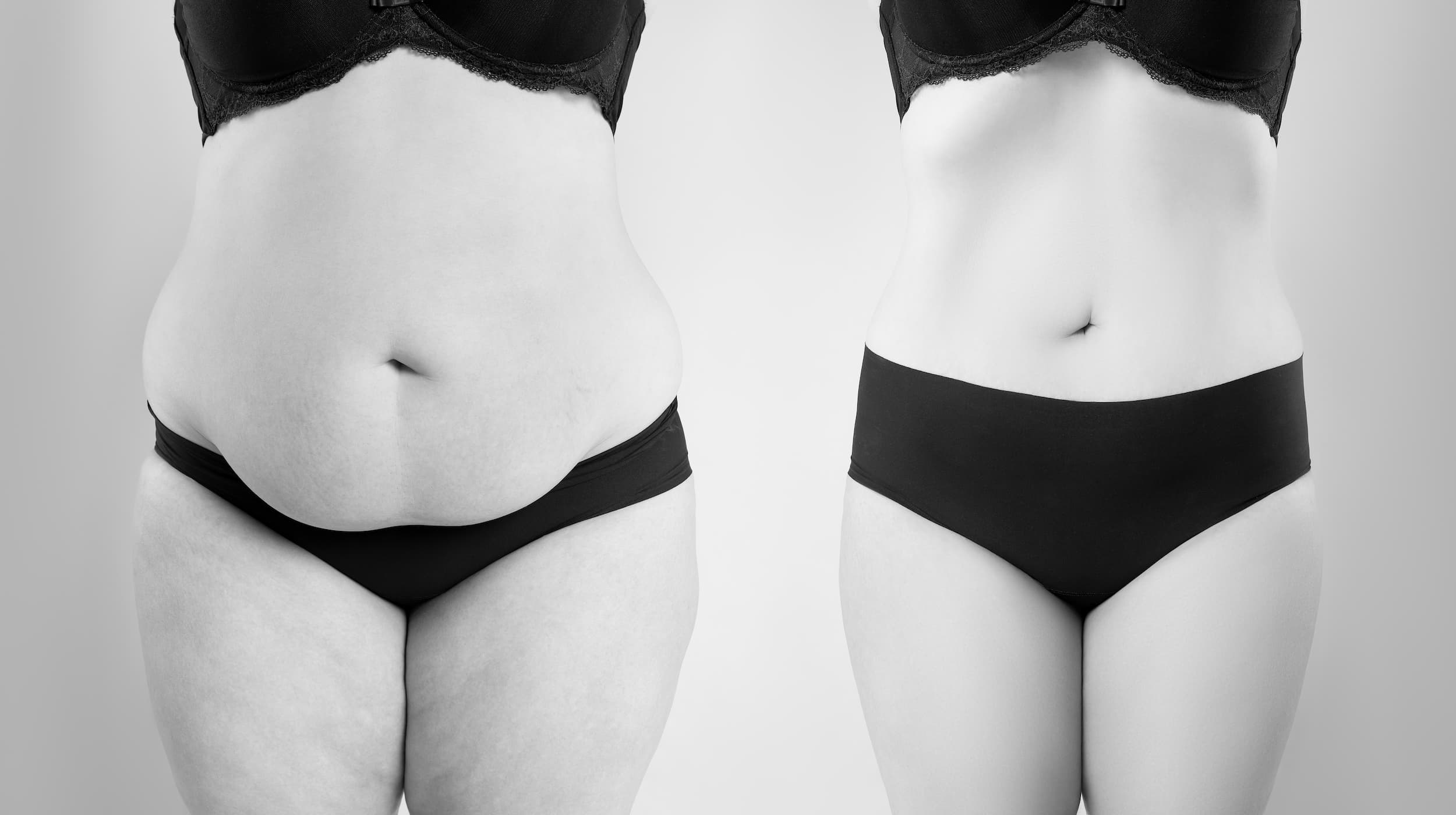 before and after photo of woman's stomach