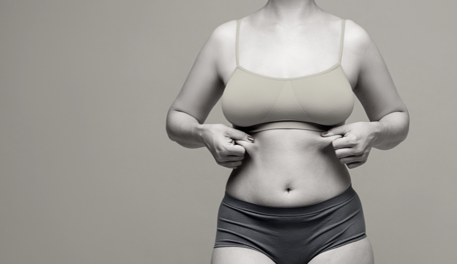 Tummy Tuck Vs Liposuction: Which Is Best?