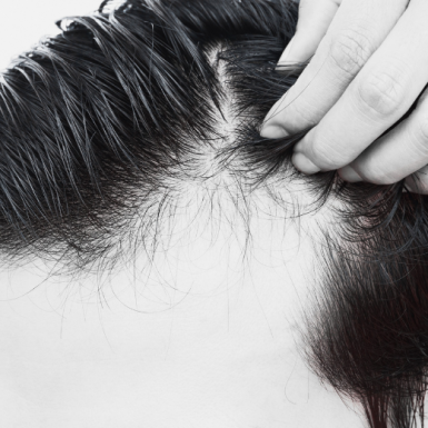 Do Hair Growth Products Actually Work?