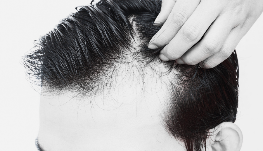 Do Hair Growth Products Actually Work?