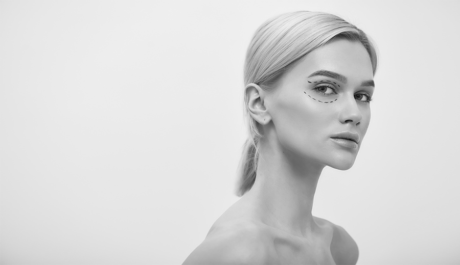 How to Prevent Blepharoplasty Scars | SpaMedica