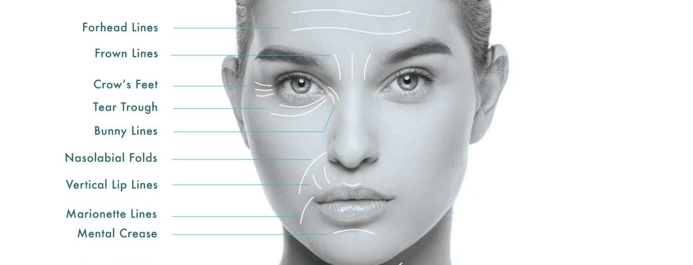 The Complete Guide to Wrinkles SpaMedica