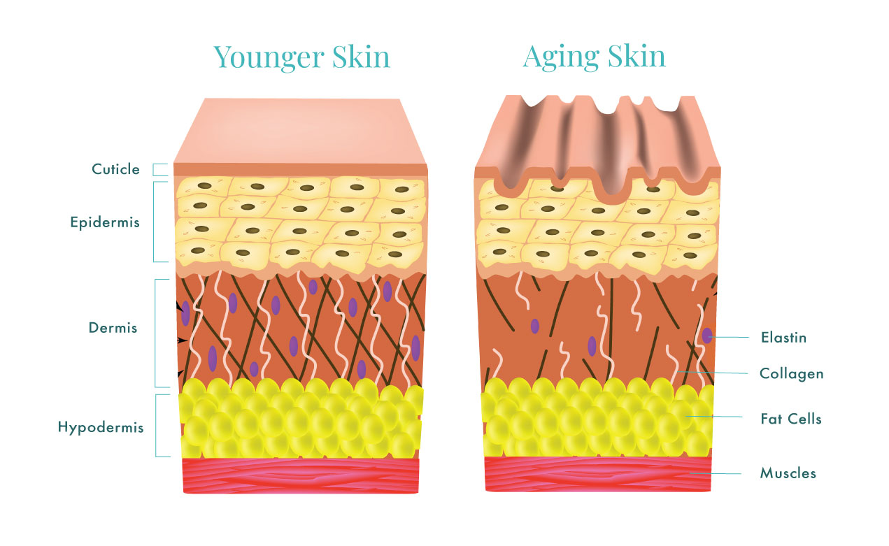 skin comparison illustration: younger skin vs aging skin