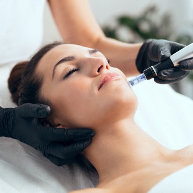 The image shows a woman receiving a SilkPeel treatment.