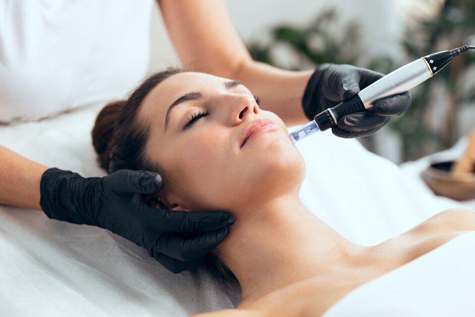 The image shows a woman receiving a SilkPeel treatment.