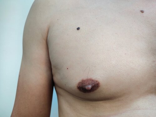 Prevent Nipples From Protruding Out! 