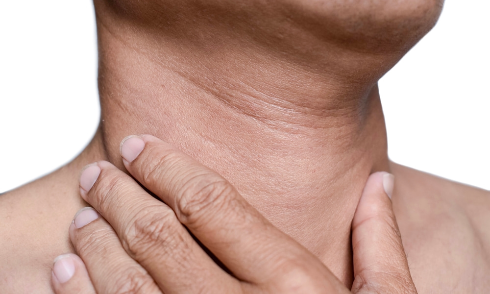 How to lose sales neck fat lines