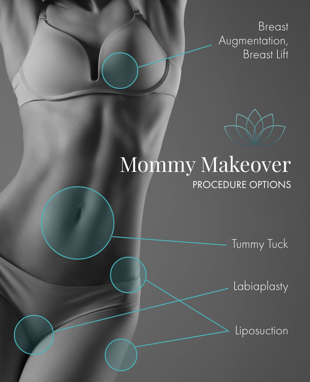 Common Mommy Makeover Procedures with Treatment Areas.