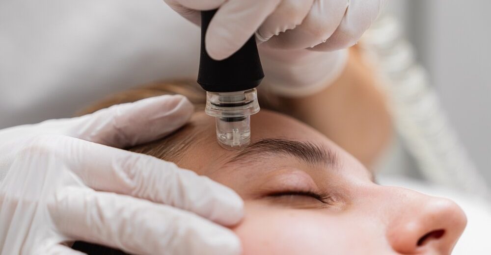 Close-up of a person receiving a microdermabrasion treatment on the forehead, performed by a professional with gloves.